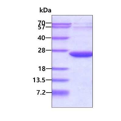 SDS-PAGE: Recombinant Human VPS25 His Protein [NBP1-99072]